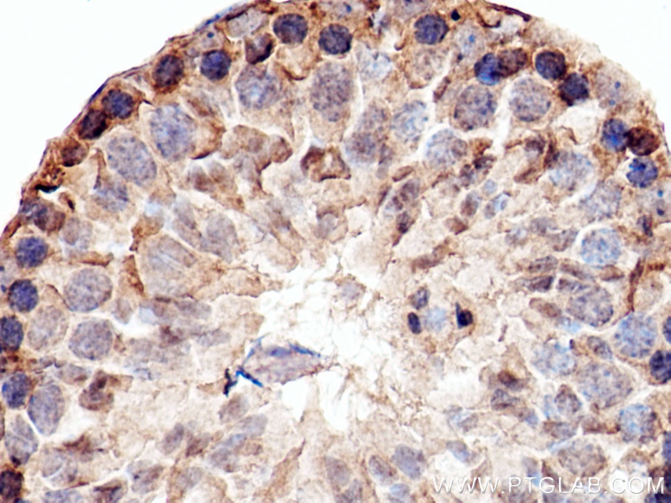 Immunohistochemistry (IHC) staining of mouse testis tissue using PRR5 Polyclonal antibody (17948-1-AP)