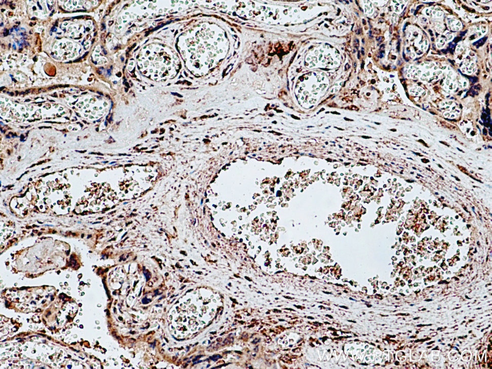 Immunohistochemistry (IHC) staining of human placenta tissue using PRR5 Polyclonal antibody (17948-1-AP)