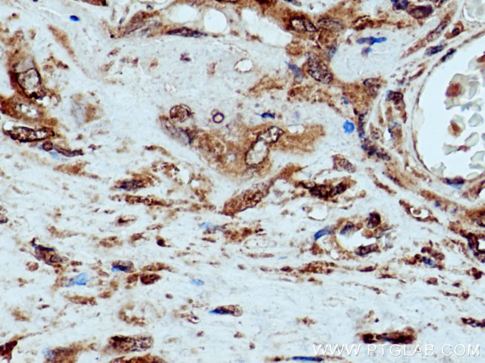 Immunohistochemistry (IHC) staining of human placenta tissue using PRR5 Polyclonal antibody (17948-1-AP)