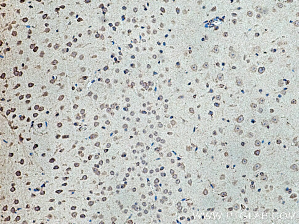 Immunohistochemistry (IHC) staining of mouse brain tissue using PRR5 Polyclonal antibody (17948-1-AP)