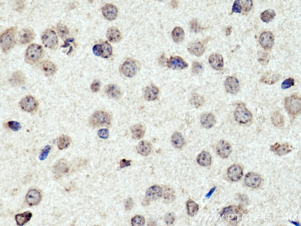 Immunohistochemistry (IHC) staining of mouse brain tissue using PRR5 Polyclonal antibody (17948-1-AP)