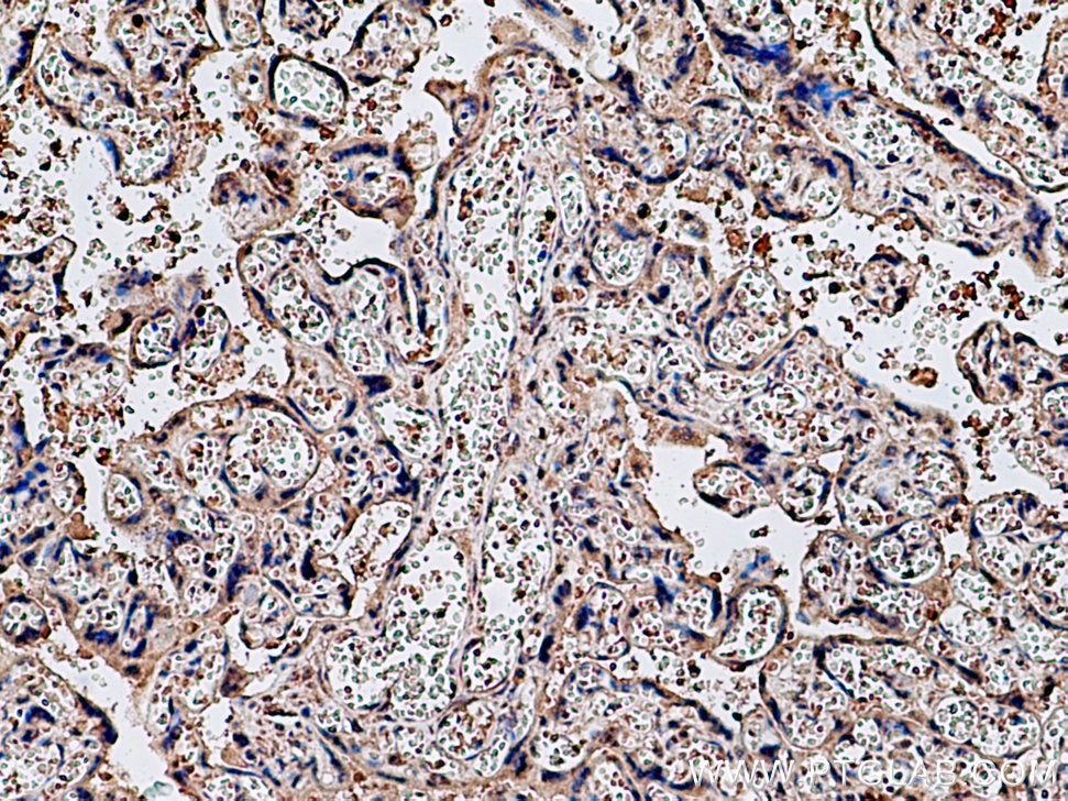 Immunohistochemistry (IHC) staining of human placenta tissue using PRR5 Polyclonal antibody (17948-1-AP)