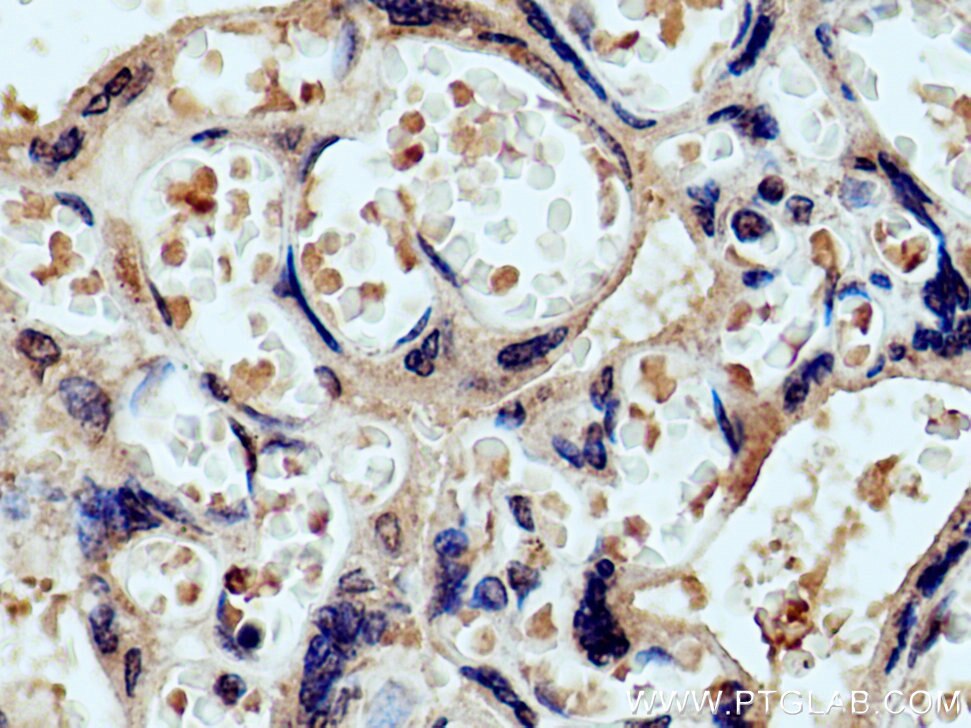 Immunohistochemistry (IHC) staining of human placenta tissue using PRR5 Polyclonal antibody (17948-1-AP)