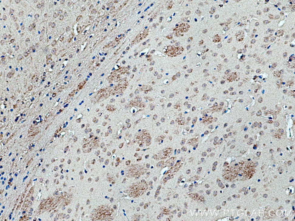 Immunohistochemistry (IHC) staining of mouse brain tissue using PRR5 Polyclonal antibody (17948-1-AP)