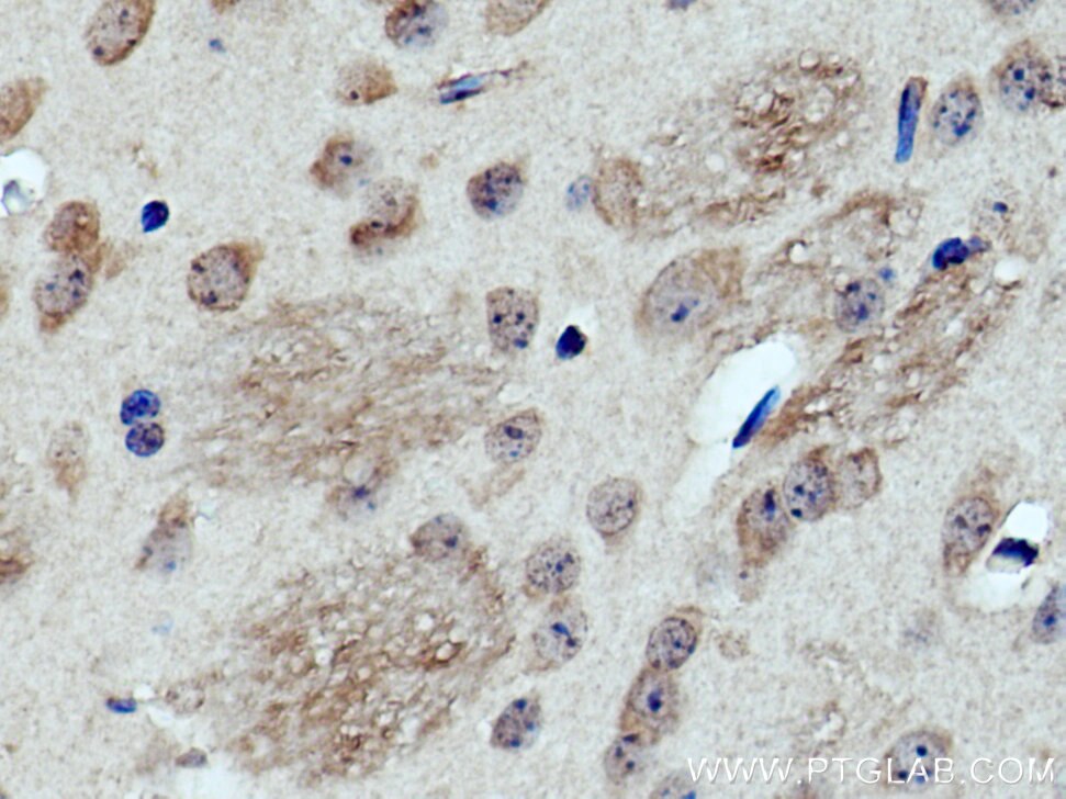 Immunohistochemistry (IHC) staining of mouse brain tissue using PRR5 Polyclonal antibody (17948-1-AP)