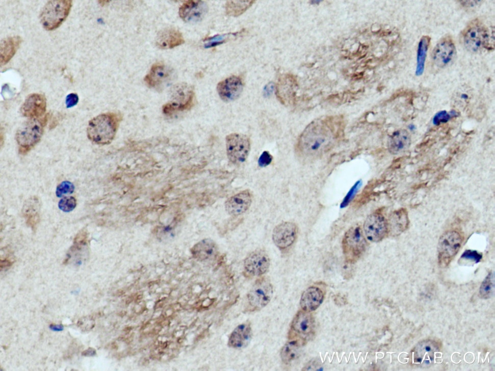 IHC staining of mouse brain using 17948-1-AP