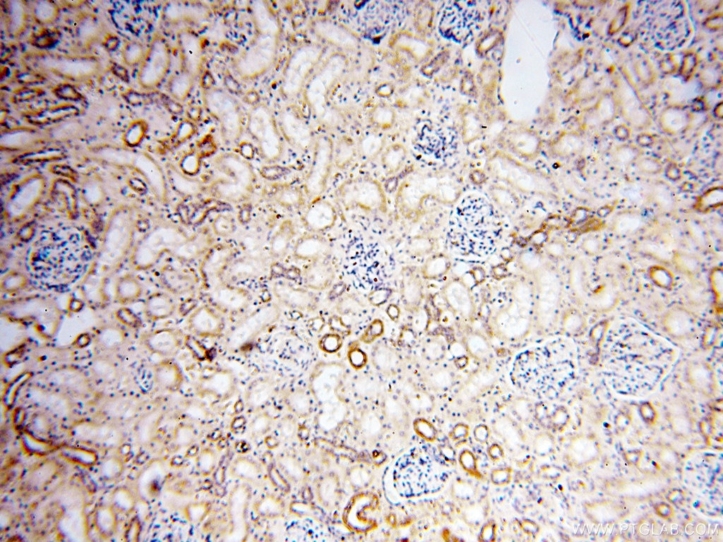 Immunohistochemistry (IHC) staining of human kidney tissue using PRR5 Polyclonal antibody (17948-1-AP)