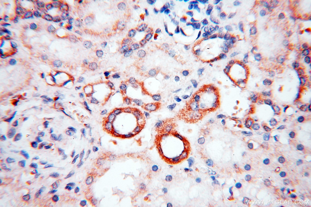 Immunohistochemistry (IHC) staining of human kidney tissue using PRR5 Polyclonal antibody (17948-1-AP)