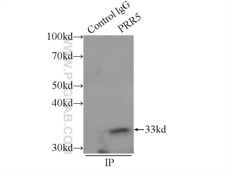 Immunoprecipitation (IP) experiment of mouse brain tissue using PRR5 Polyclonal antibody (17948-1-AP)