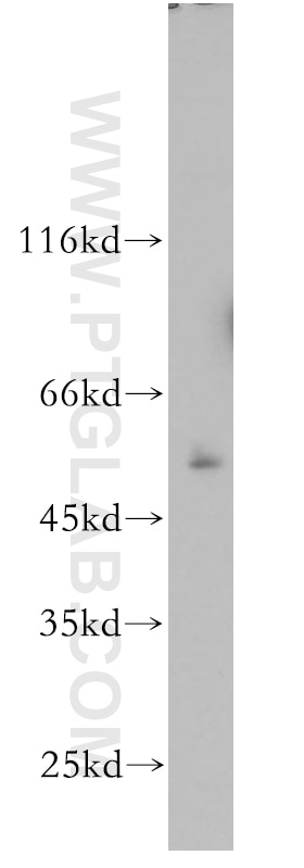 Western Blot (WB) analysis of human brain tissue using PRR5 Polyclonal antibody (17948-1-AP)