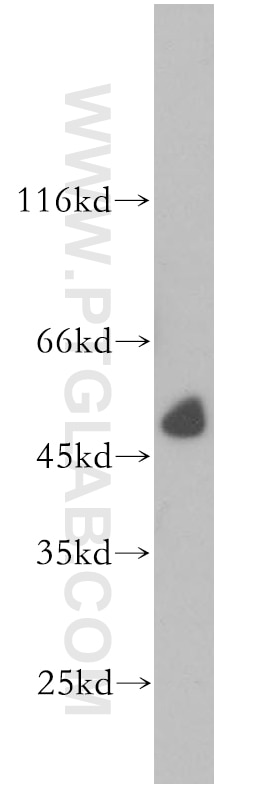 Western Blot (WB) analysis of human kidney tissue using PRR5 Polyclonal antibody (17948-1-AP)