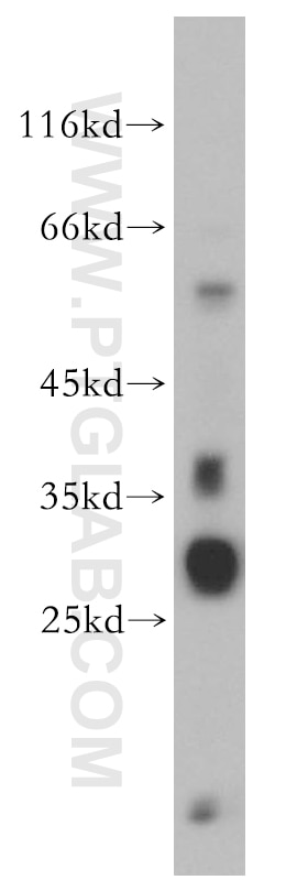 Western Blot (WB) analysis of HEK-293 cells using PRR5 Polyclonal antibody (17948-1-AP)