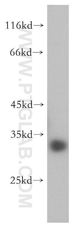 Western Blot (WB) analysis of COLO 320 cells using PRR5 Polyclonal antibody (17948-1-AP)