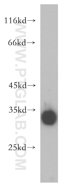 Western Blot (WB) analysis of mouse brain tissue using PRR5 Polyclonal antibody (17948-1-AP)