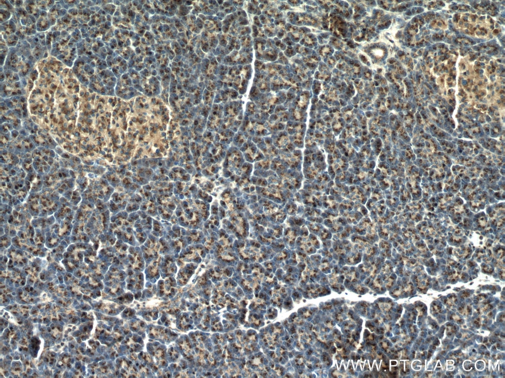 Immunohistochemistry (IHC) staining of human pancreas tissue using PRRC1 Polyclonal antibody (27887-1-AP)