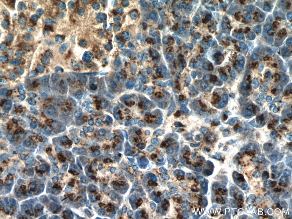 Immunohistochemistry (IHC) staining of human pancreas tissue using PRRC1 Polyclonal antibody (27887-1-AP)