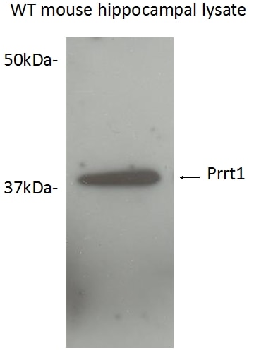 Western Blot (WB) analysis of mouse hippocampal tissue using SynDIG4/PRRT1 Polyclonal antibody (17261-1-AP)