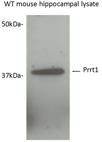 SynDIG4/PRRT1