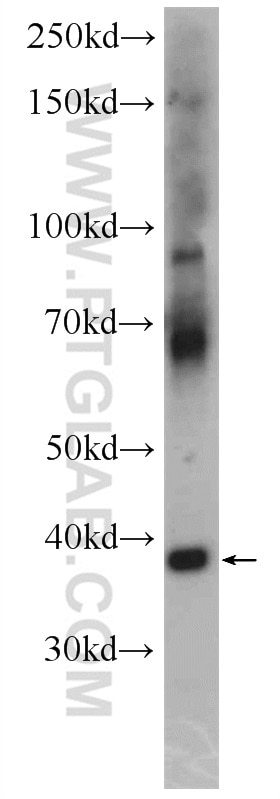 Western Blot (WB) analysis of mouse brain tissue using SynDIG4/PRRT1 Polyclonal antibody (17261-1-AP)