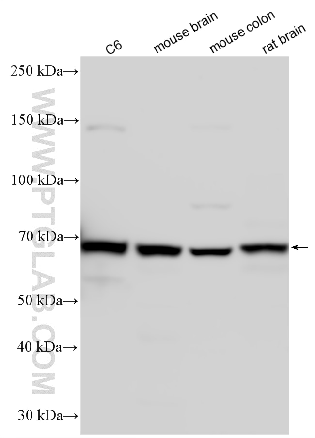 WB analysis using 26572-1-AP Western Blot (WB) analysis of various lysates using PRRT3 Polyclonal antibody (26572-1-AP)