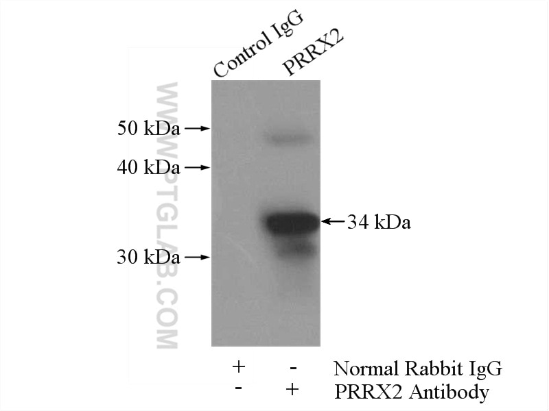 Immunoprecipitation (IP) experiment of mouse brain tissue using PRRX2 Polyclonal antibody (23869-1-AP)
