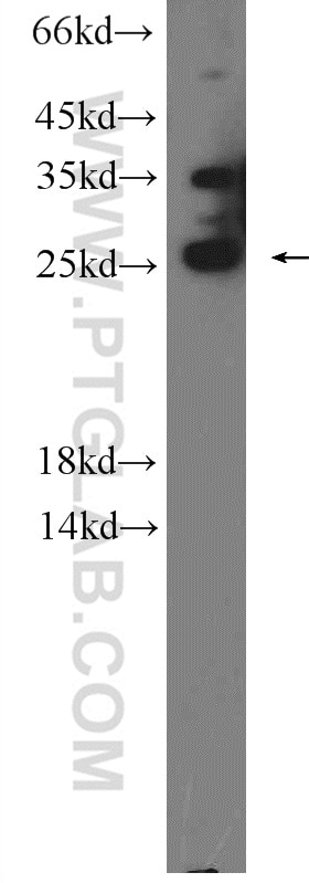 Western Blot (WB) analysis of mouse brain tissue using PRRX2 Polyclonal antibody (23869-1-AP)