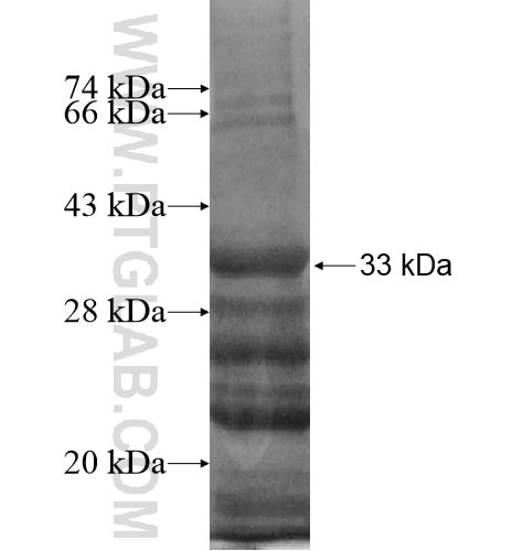 PRRX2 fusion protein Ag13503 SDS-PAGE