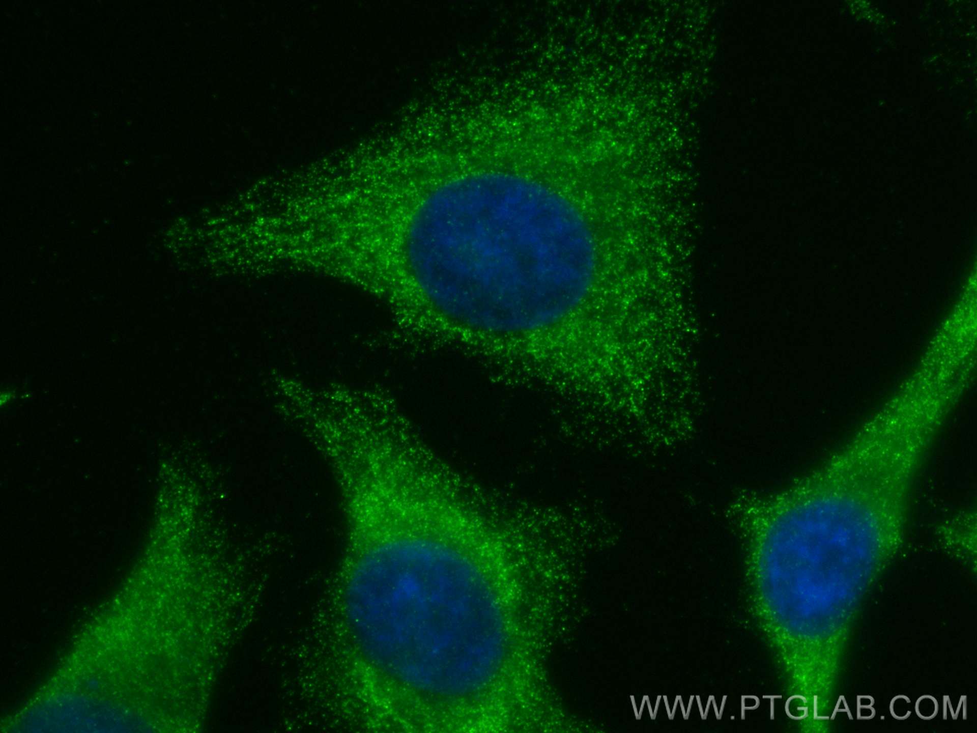 Immunofluorescence (IF) / fluorescent staining of HeLa cells using Trypsin 1/PRSS1 Polyclonal antibody (29790-1-AP)
