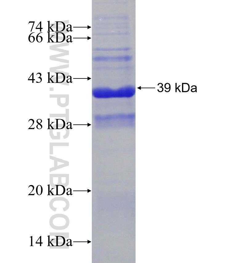 PRSS1 fusion protein Ag31383 SDS-PAGE
