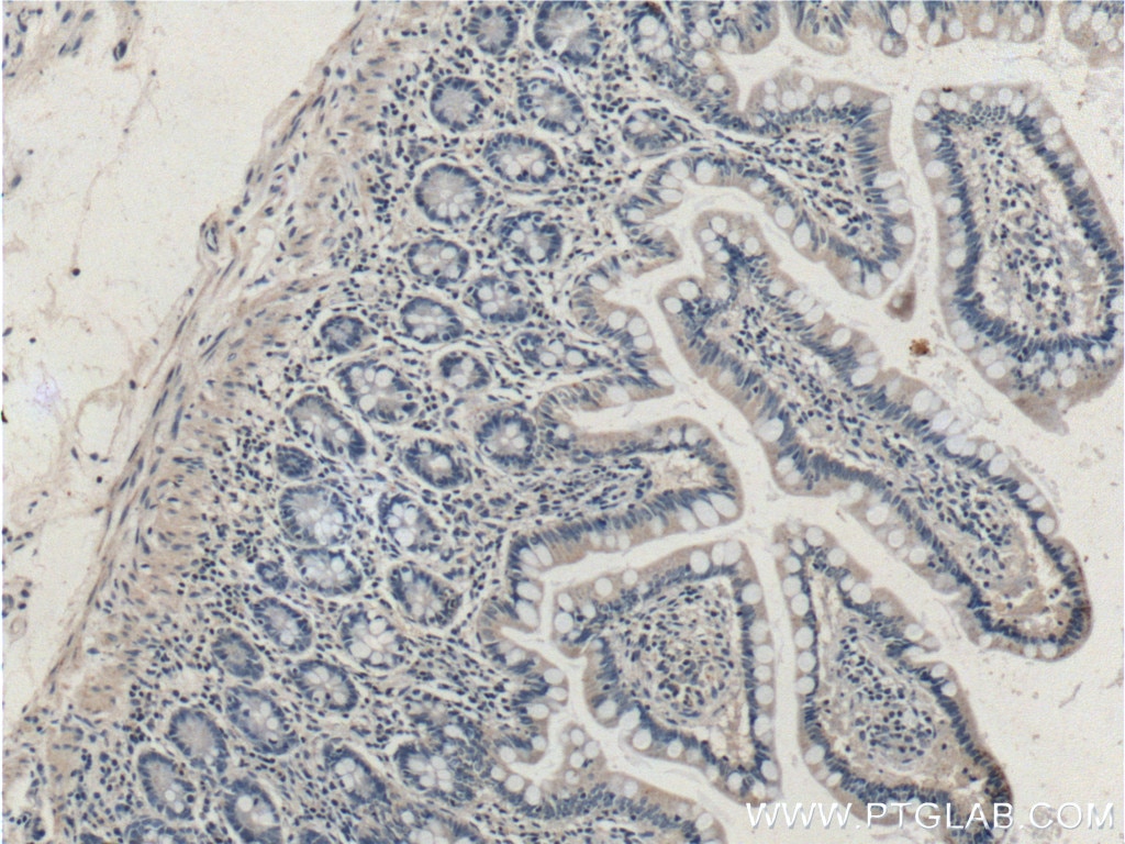 Immunohistochemistry (IHC) staining of human small intestine tissue using PRSS2 Polyclonal antibody (15005-1-AP)