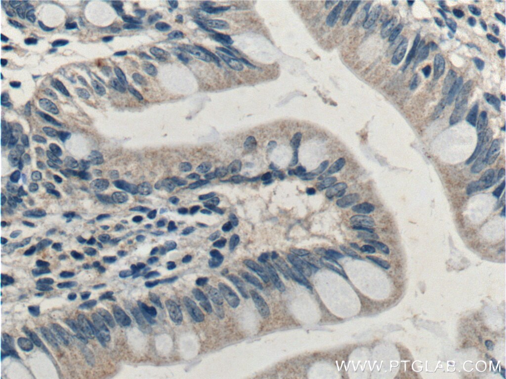 Immunohistochemistry (IHC) staining of human small intestine tissue using PRSS2 Polyclonal antibody (15005-1-AP)