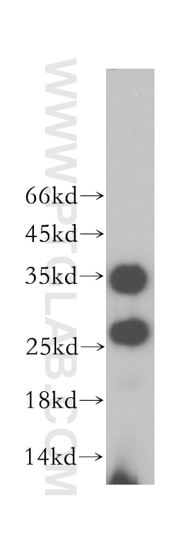 Western Blot (WB) analysis of Raji cells using PRSS2 Polyclonal antibody (15005-1-AP)