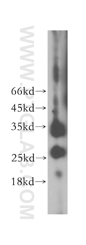 Western Blot (WB) analysis of HepG2 cells using PRSS2 Polyclonal antibody (15005-1-AP)