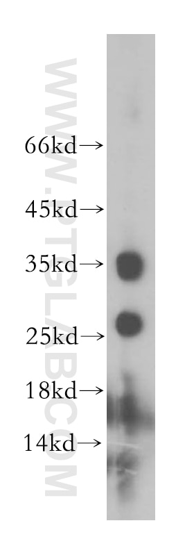 Western Blot (WB) analysis of mouse thymus tissue using PRSS2 Polyclonal antibody (15005-1-AP)