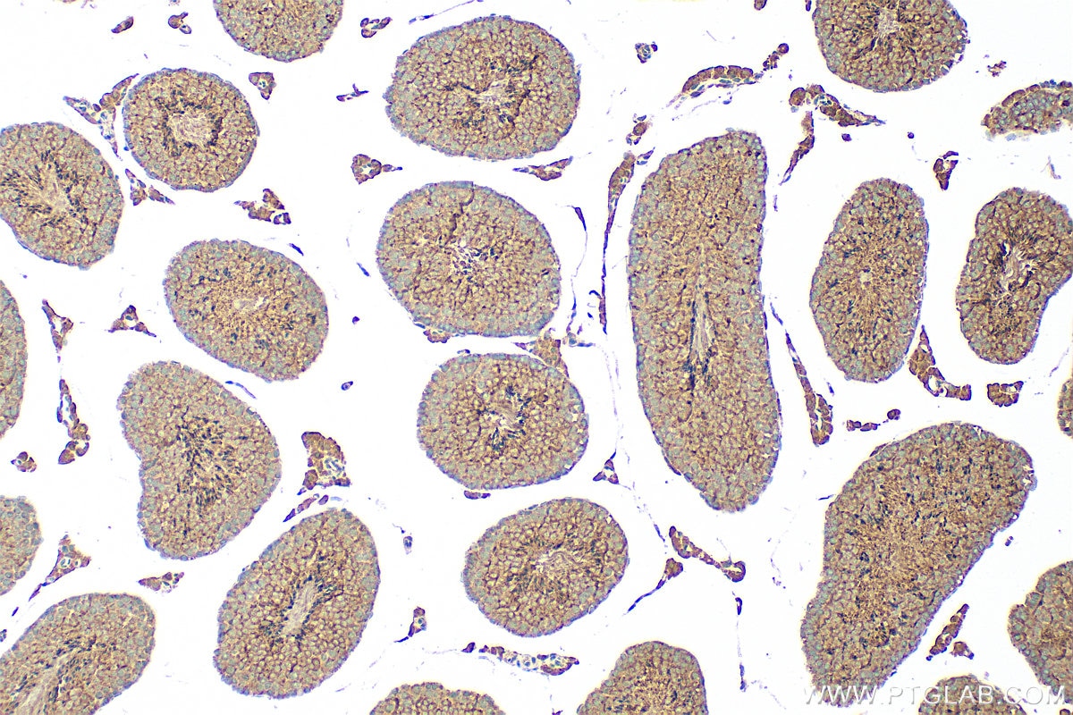 Immunohistochemistry (IHC) staining of mouse testis tissue using PRSS21 Polyclonal antibody (32522-1-AP)