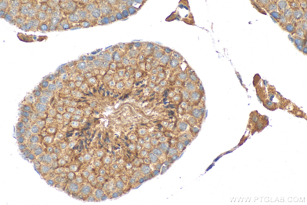 Immunohistochemistry (IHC) staining of mouse testis tissue using PRSS21 Polyclonal antibody (32522-1-AP)