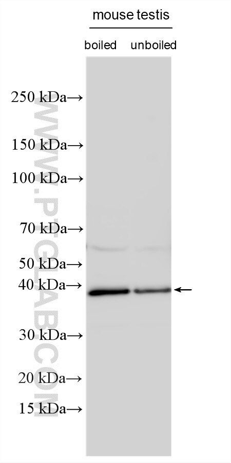 Western Blot (WB) analysis of various lysates using PRSS21 Polyclonal antibody (32522-1-AP)