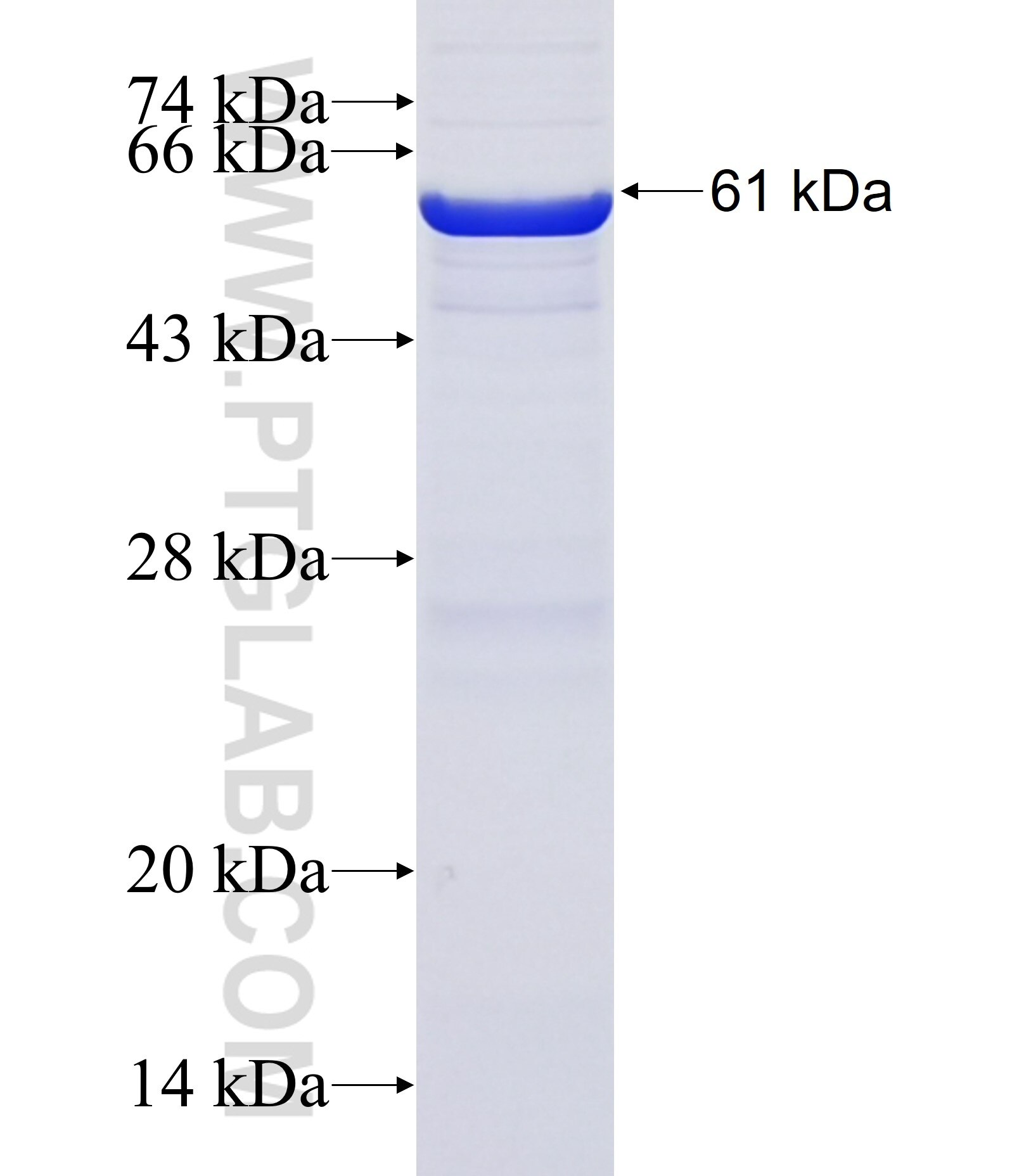 PRSS21 fusion protein Ag38156 SDS-PAGE