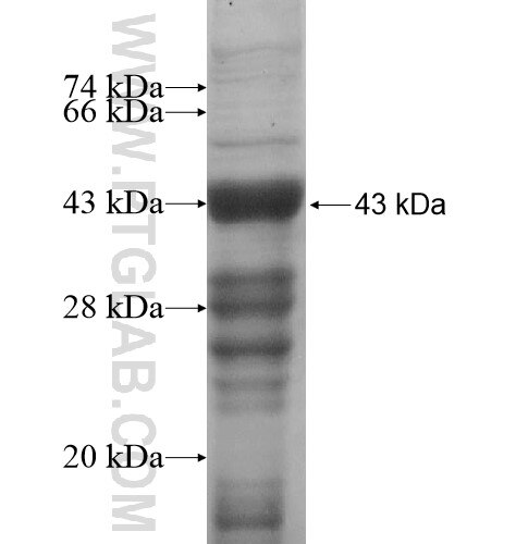 PRSS23 fusion protein Ag10491 SDS-PAGE