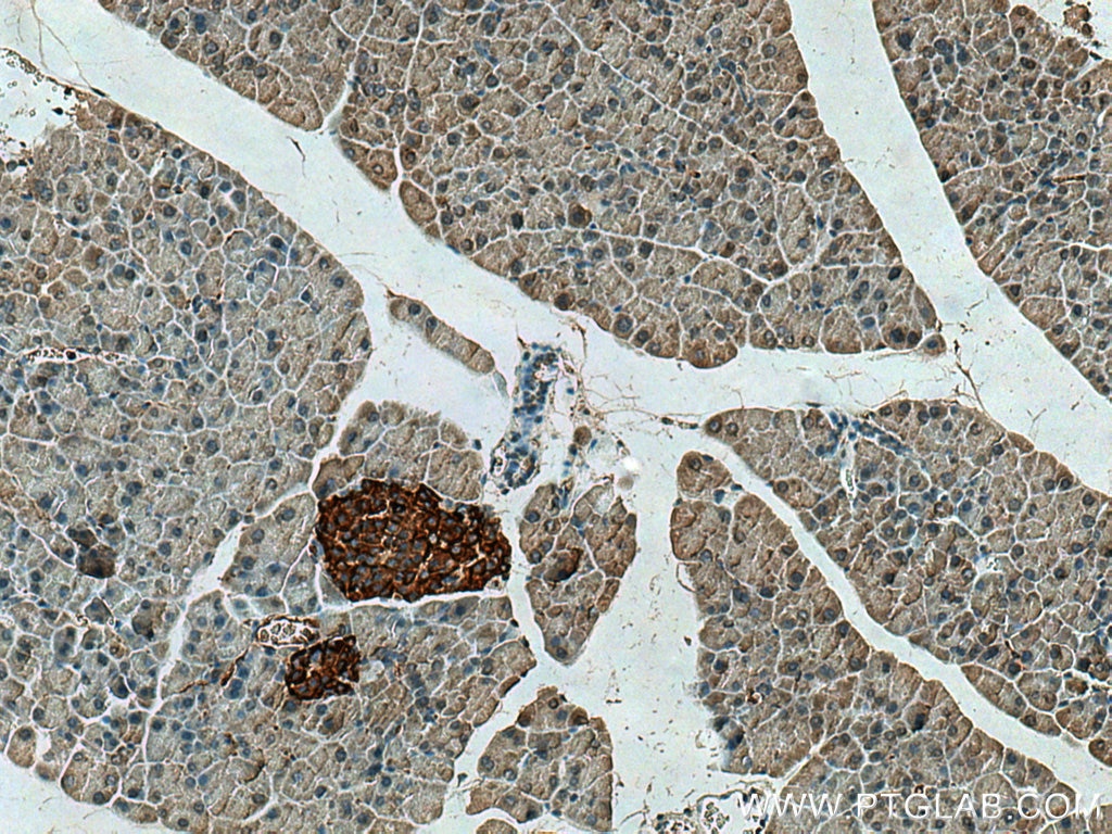 Immunohistochemistry (IHC) staining of mouse pancreas tissue using PRSS27 Polyclonal antibody (19515-1-AP)