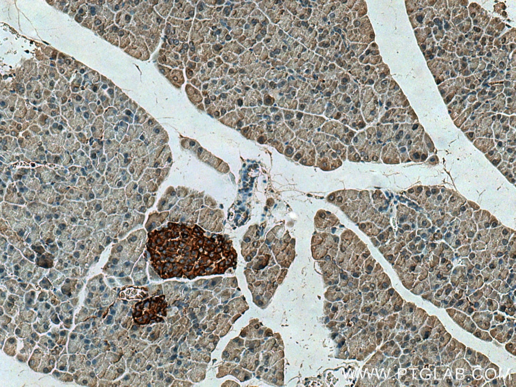 IHC staining of mouse pancreas using 19515-1-AP