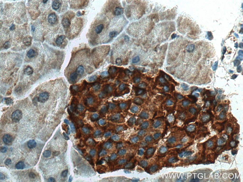 IHC staining of mouse pancreas using 19515-1-AP