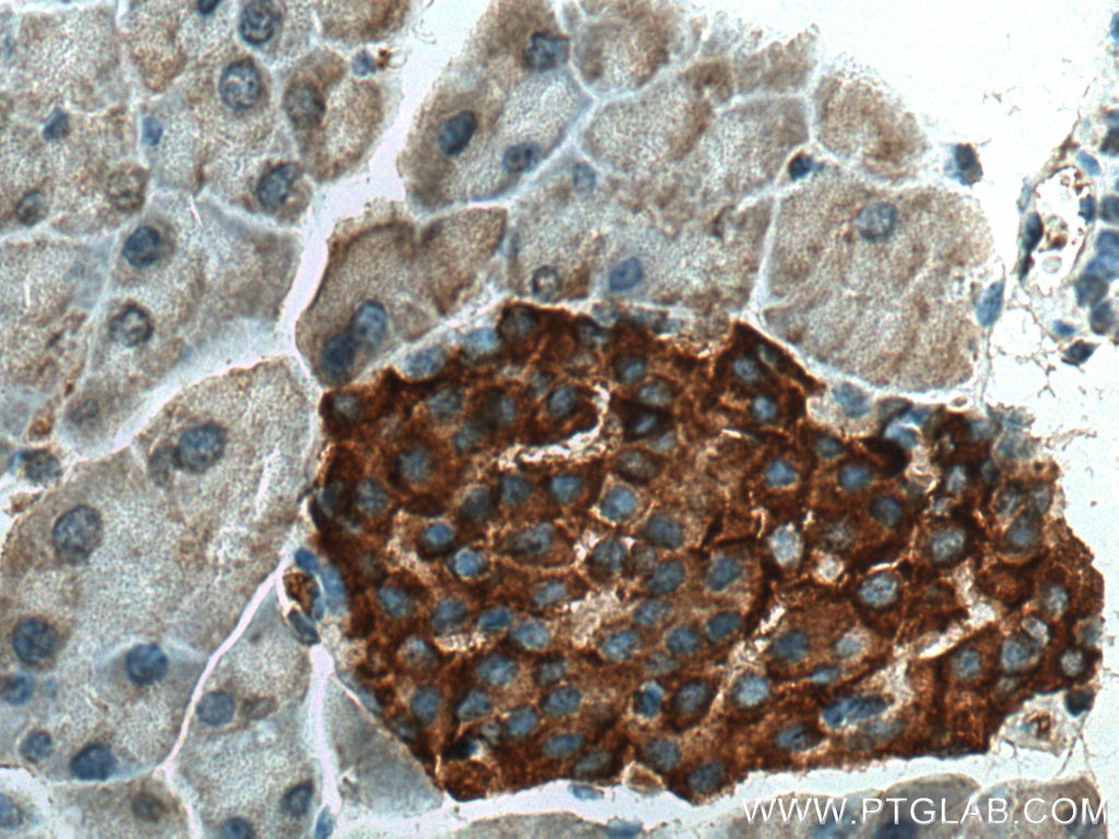 Immunohistochemistry (IHC) staining of mouse pancreas tissue using PRSS27 Polyclonal antibody (19515-1-AP)