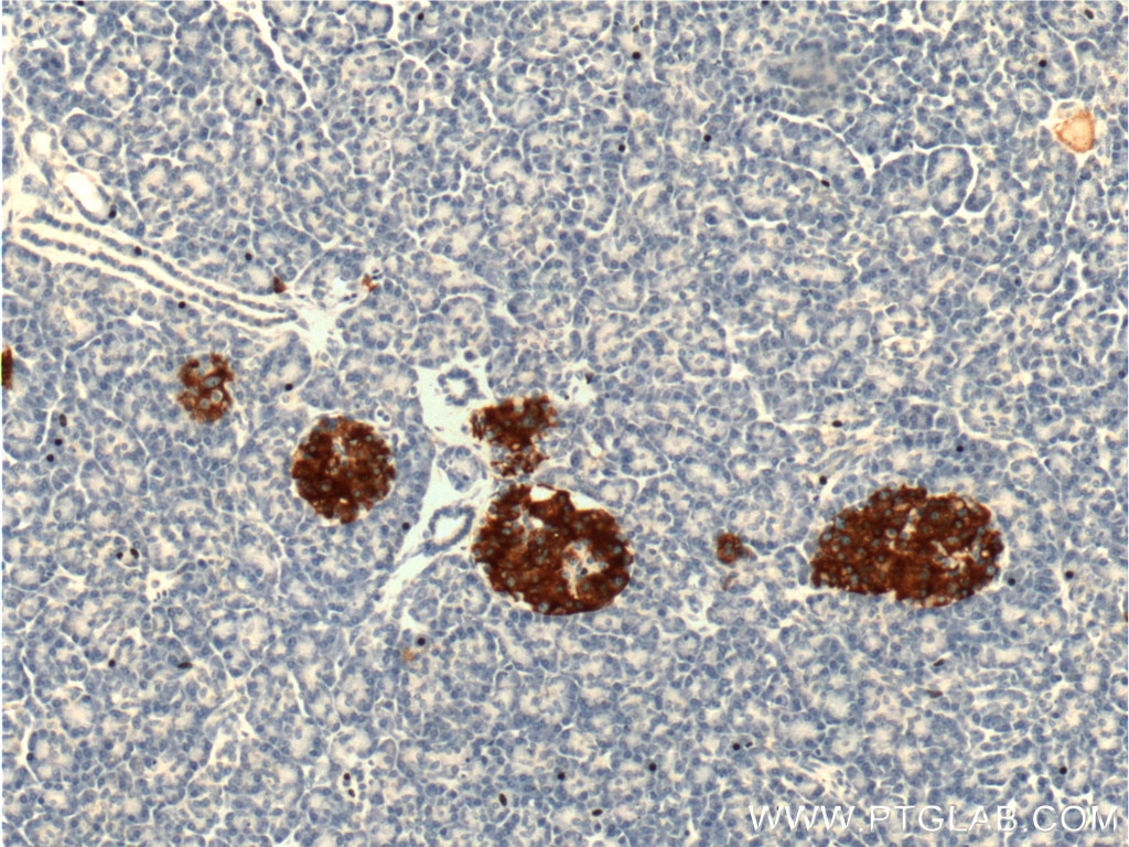 Immunohistochemistry (IHC) staining of human pancreas tissue using PRSS27 Polyclonal antibody (19515-1-AP)