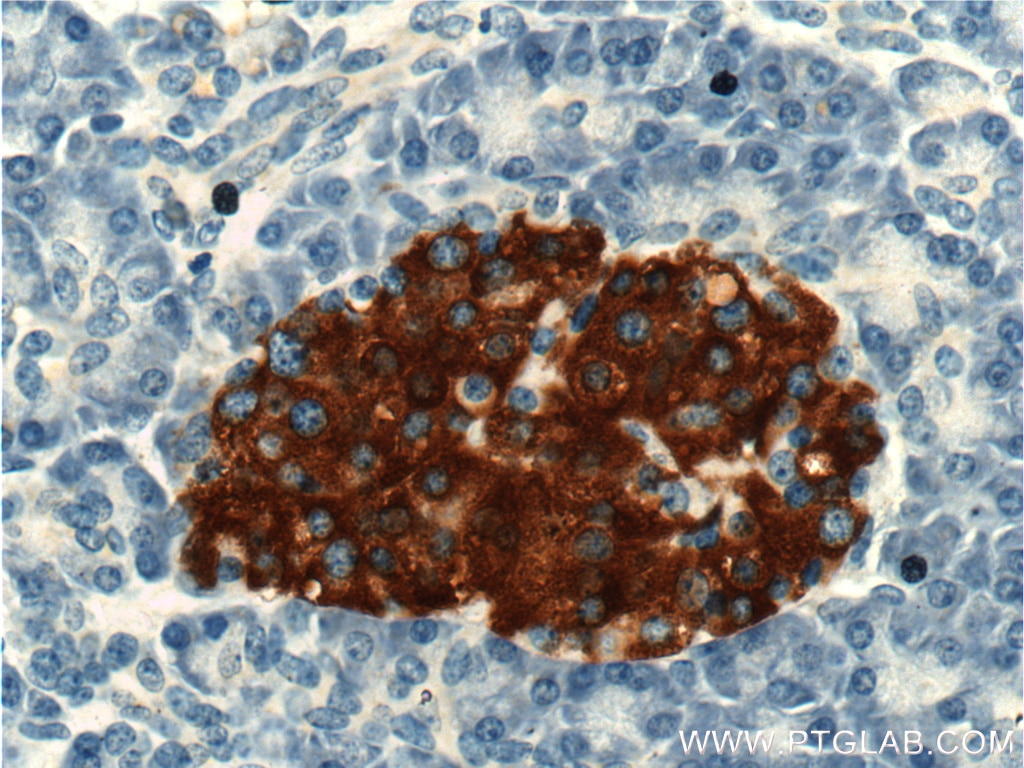 Immunohistochemistry (IHC) staining of human pancreas tissue using PRSS27 Polyclonal antibody (19515-1-AP)