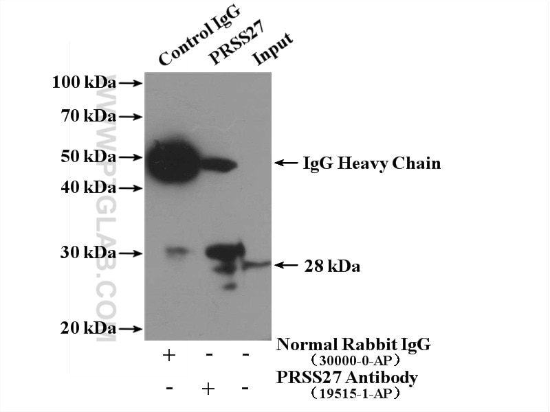Immunoprecipitation (IP) experiment of SW 1990 cells using PRSS27 Polyclonal antibody (19515-1-AP)