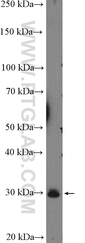 Western Blot (WB) analysis of SW 1990 cells using PRSS27 Polyclonal antibody (19515-1-AP)