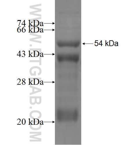 PRSS33 fusion protein Ag5559 SDS-PAGE