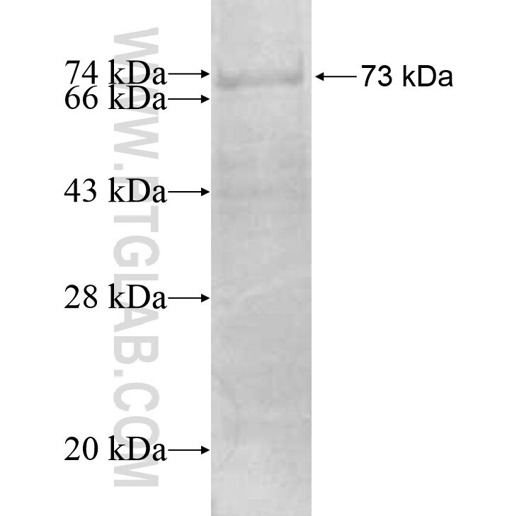 PRSS35 fusion protein Ag11570 SDS-PAGE