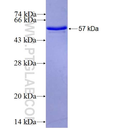 PRSS7 fusion protein Ag27144 SDS-PAGE